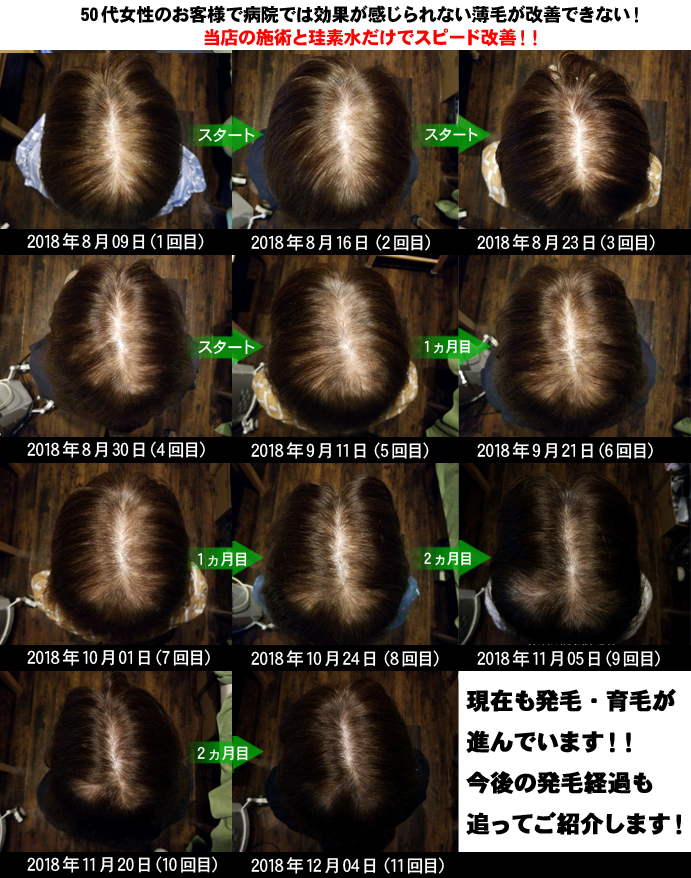 お客様からの質問 当店では中高年の方も発毛 育毛に成功されています 熊本スーパースカルプ