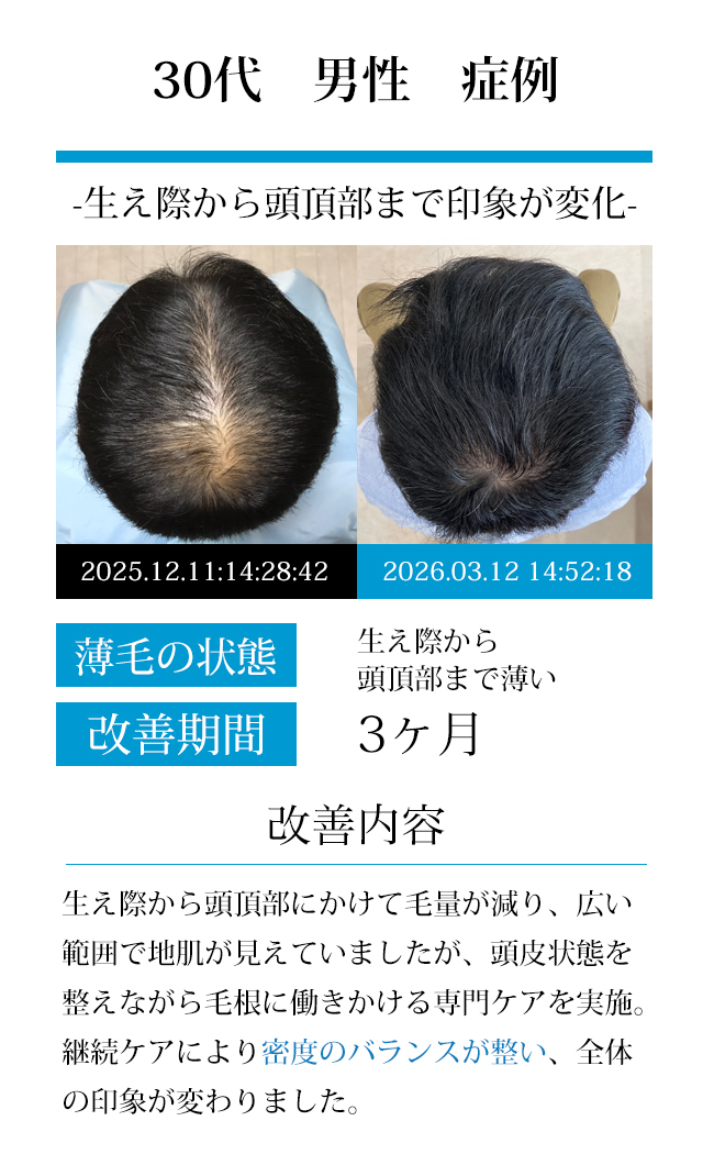 男性50代