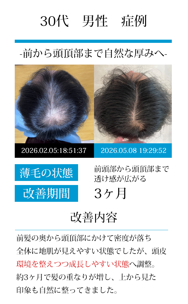 男性50代