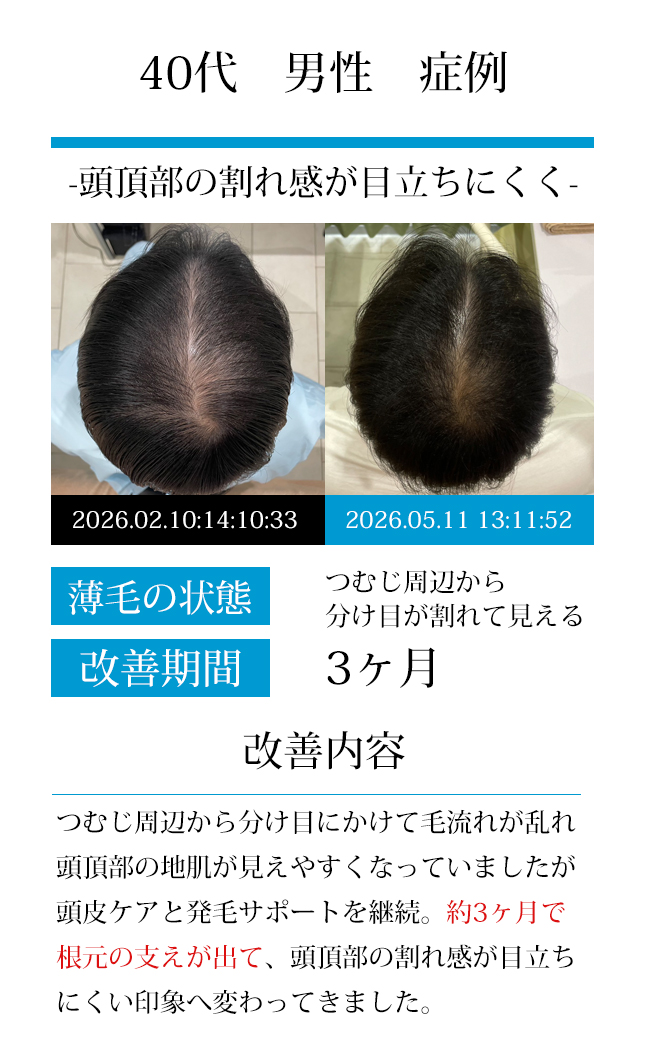 男性50代