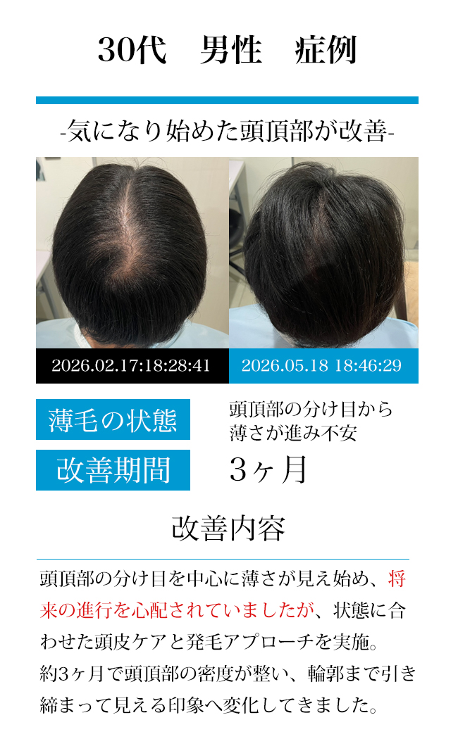 男性50代
