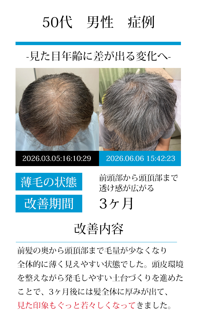 男性50代