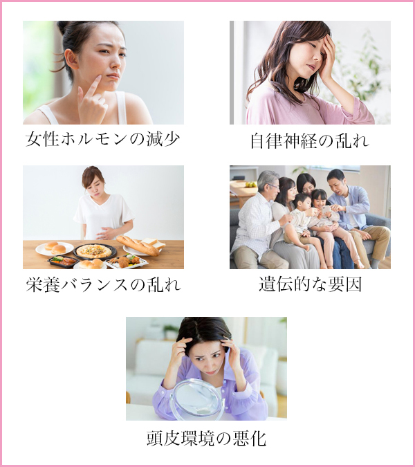 FAGA 女性の薄毛に関係する主な原因