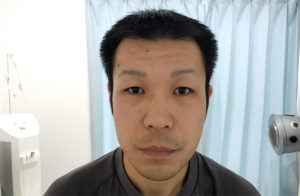 発毛実績写真