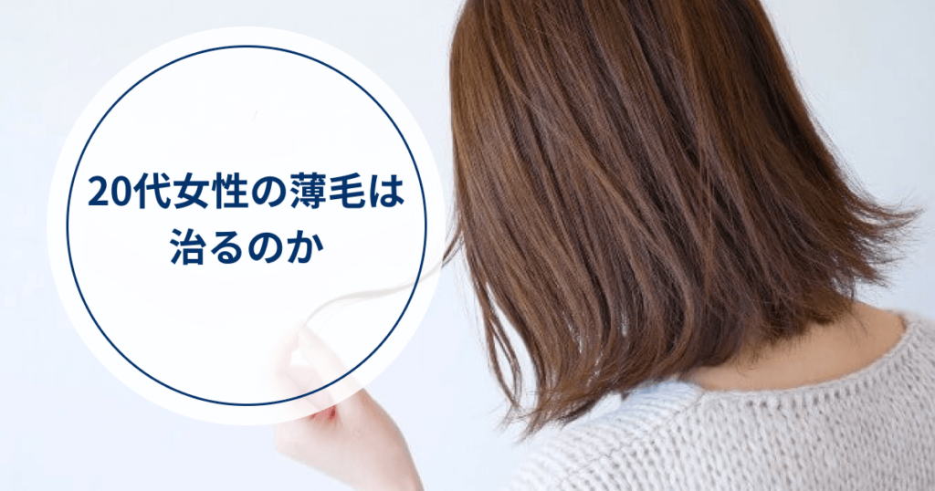 代女性が薄毛と抜け毛の悩みが急増 熊本で発毛薄毛agaはお任せ かめきちさんも発毛成功 熊本スーパー発毛センターくまなん店