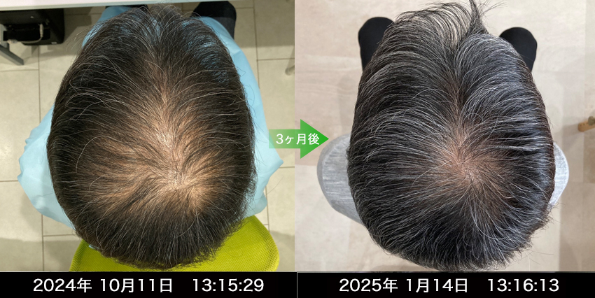 男性30代
