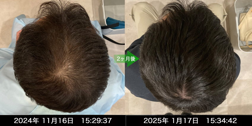 男性40代