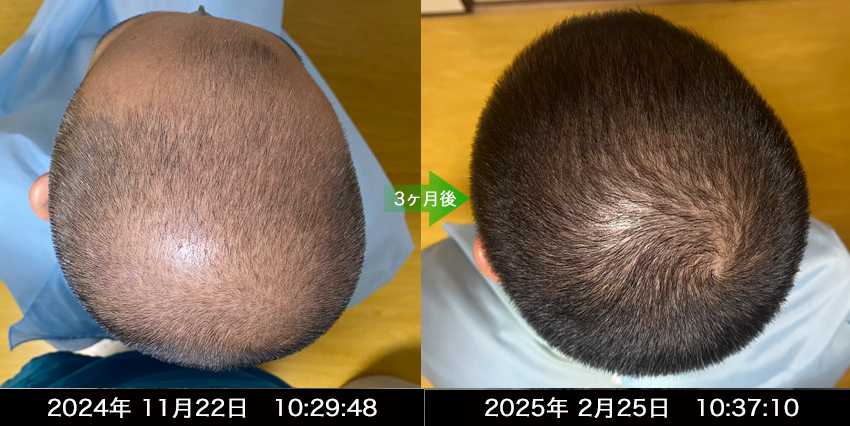 男性30代