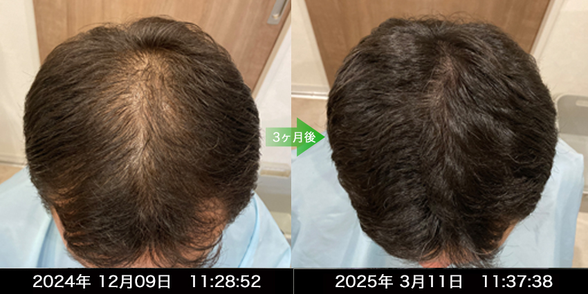 男性40代