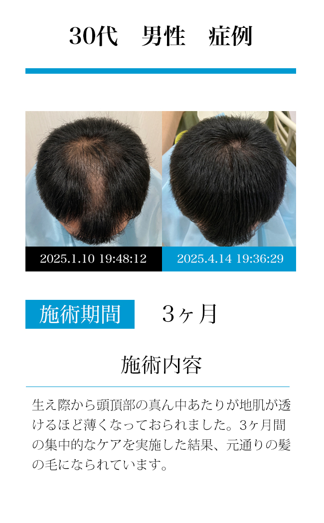男性30代