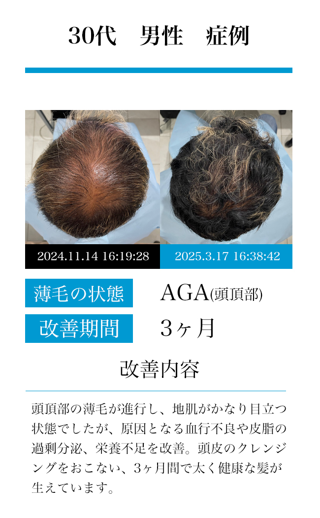男性30代
