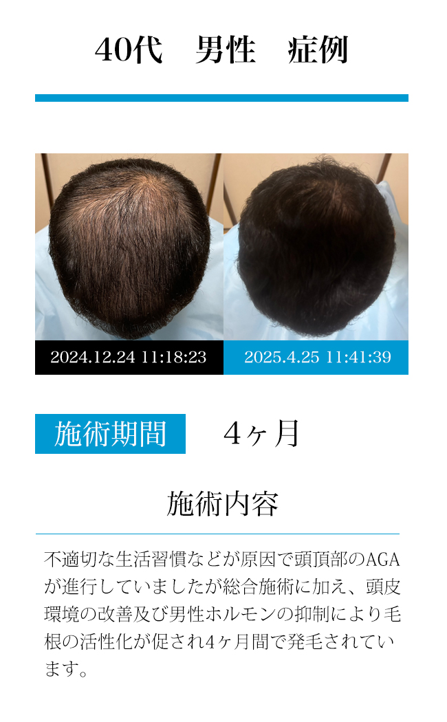 男性40代