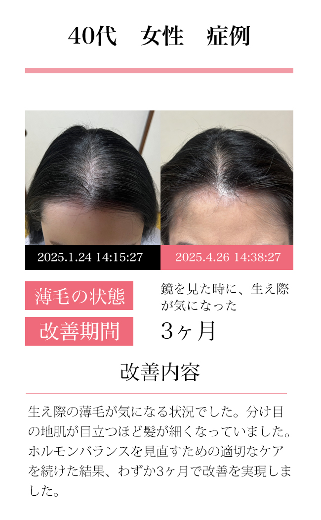 女性30代