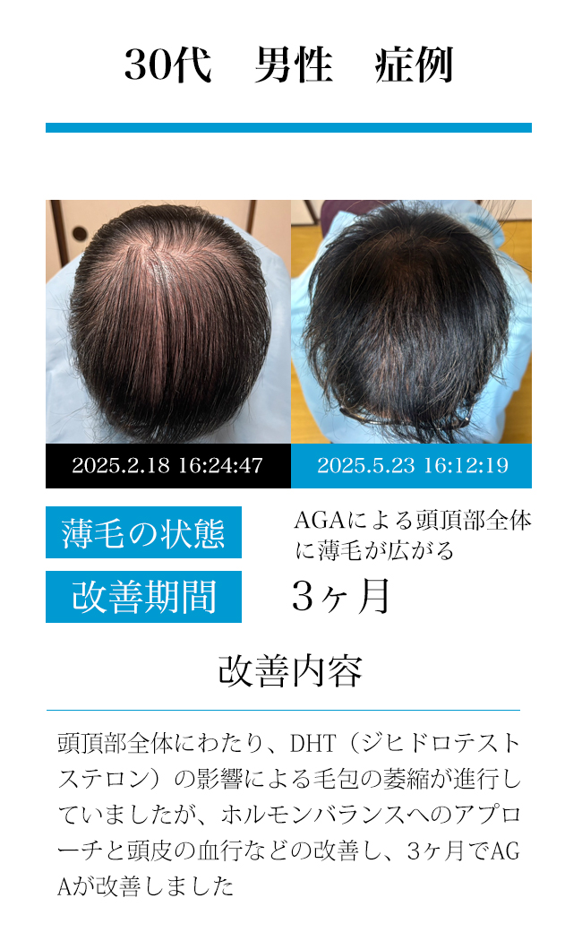 男性30代