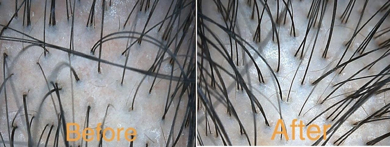 頭皮状態を確認している様子