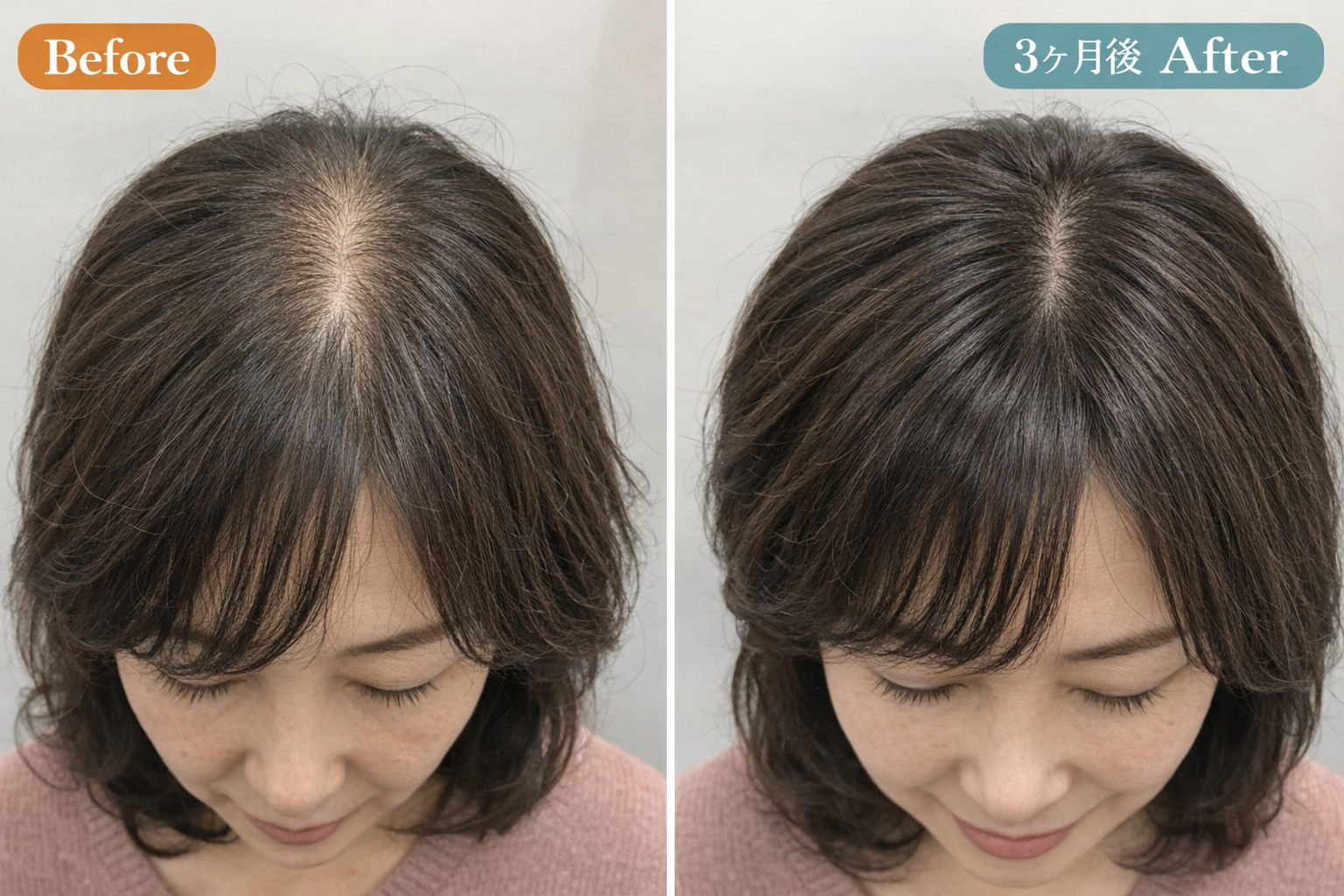 全額返金保証のイメージ